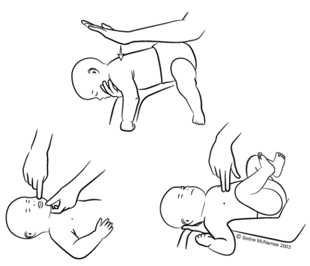 Захранване на бебе - Първа помощ при задавяне