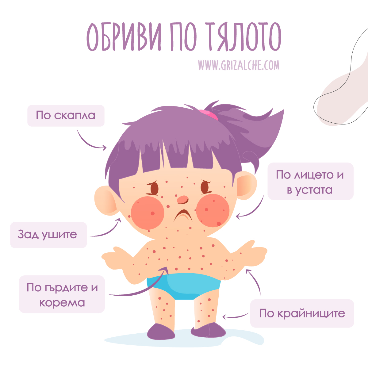 Обриви при варицела етапи на пъпките